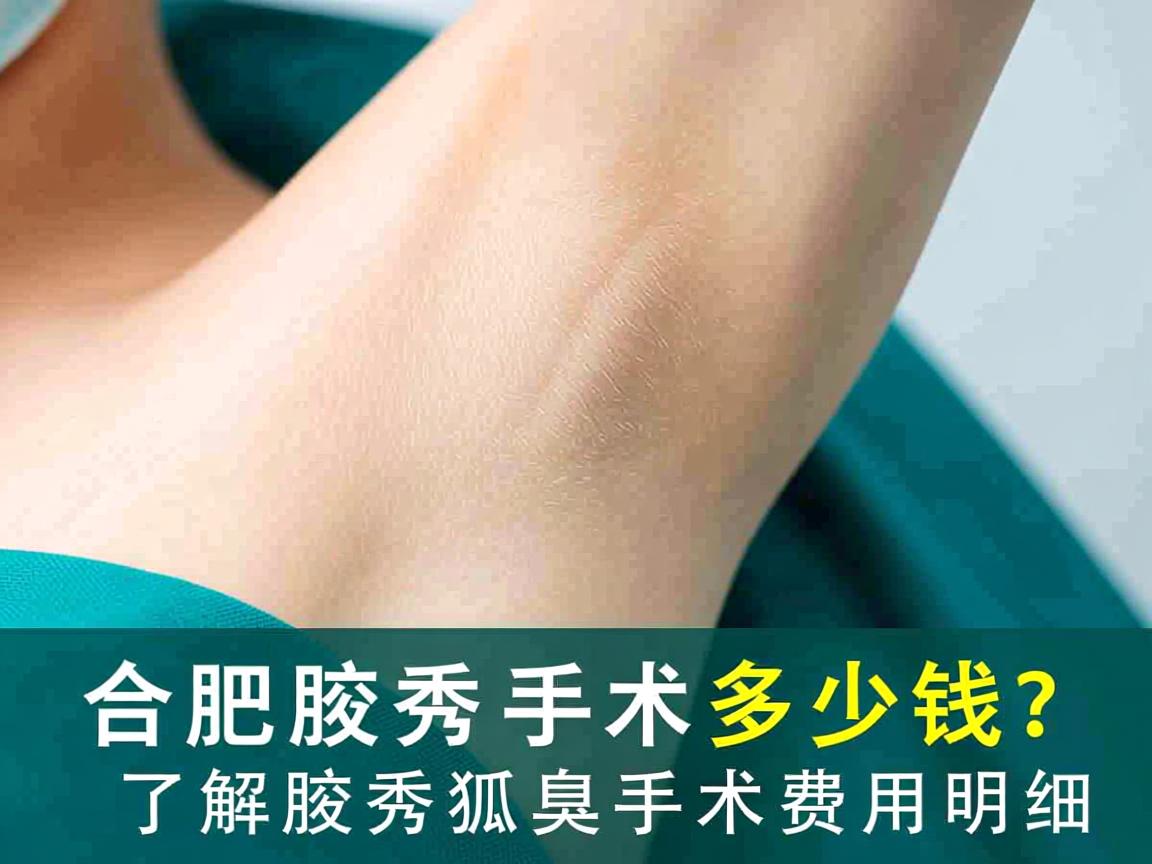 合肥腋秀腋臭手术多少钱?了解腋秀狐臭手术费用明细 合肥腋秀腋臭手术多少钱?了解腋秀狐臭手术费用明细