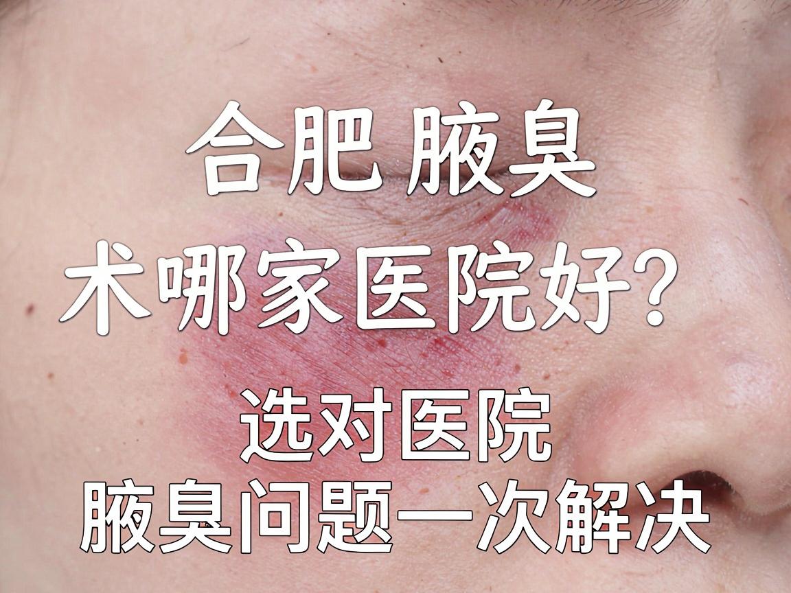 合肥腋臭微创手术哪家医院好?选对医院,腋臭问题一次解决 合肥腋臭微创手术哪家医院好?选对医院,腋臭问题一次解决