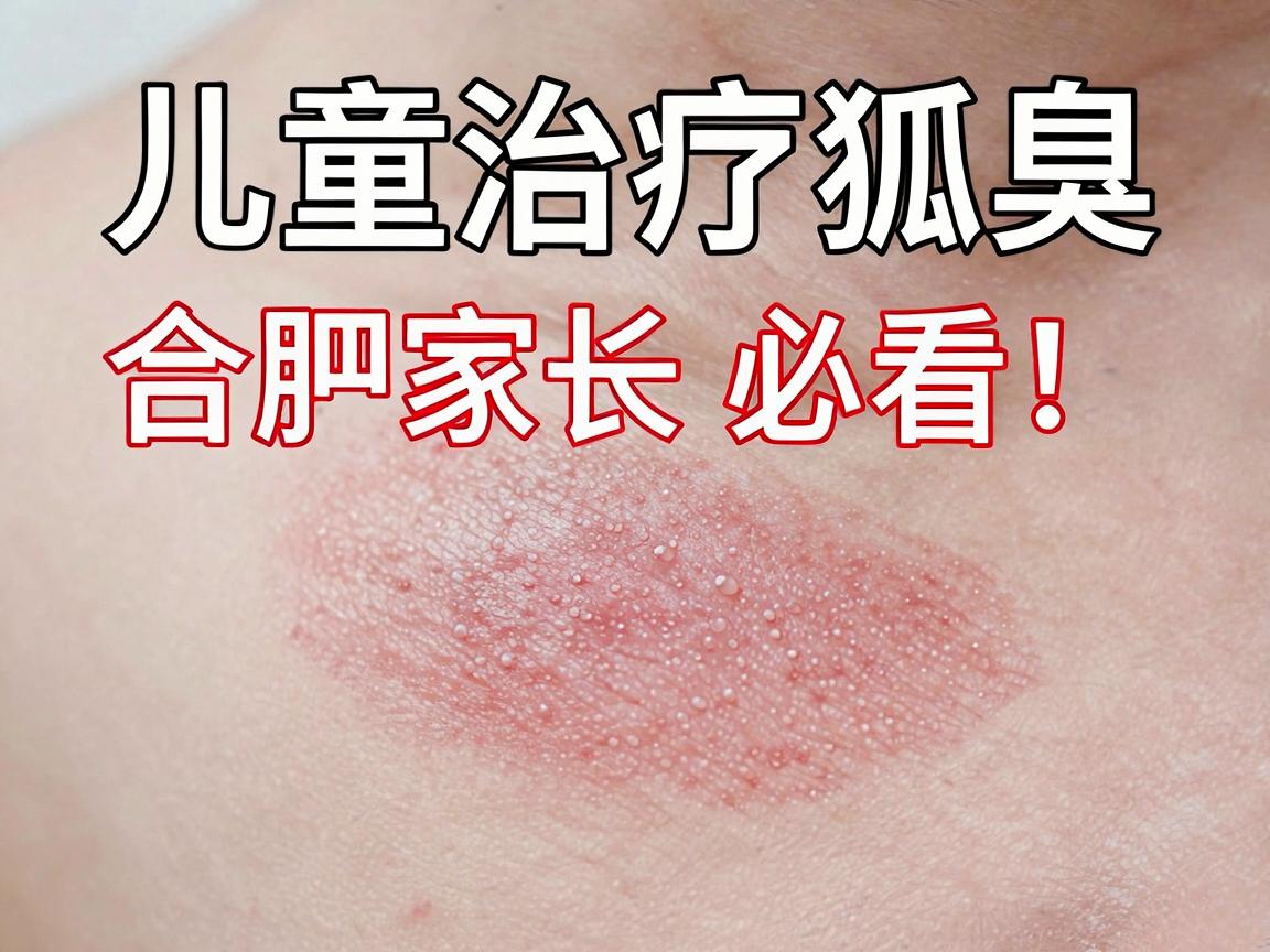 儿童治疗狐臭,合肥家长必看!儿童狐臭治疗,这些方法更靠谱 儿童治疗狐臭,合肥家长必看!儿童狐臭治疗,这些方法更靠谱