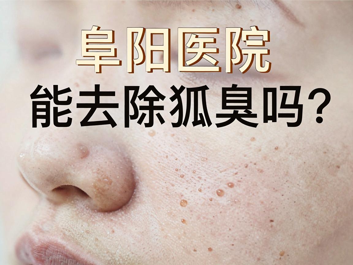 阜阳医院能去除狐臭吗？狐臭根治方法全解析