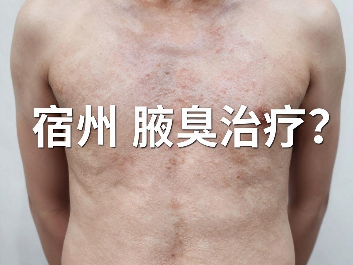 宿州腋下微创手术医院怎么选？宿州腋臭治疗指南来了