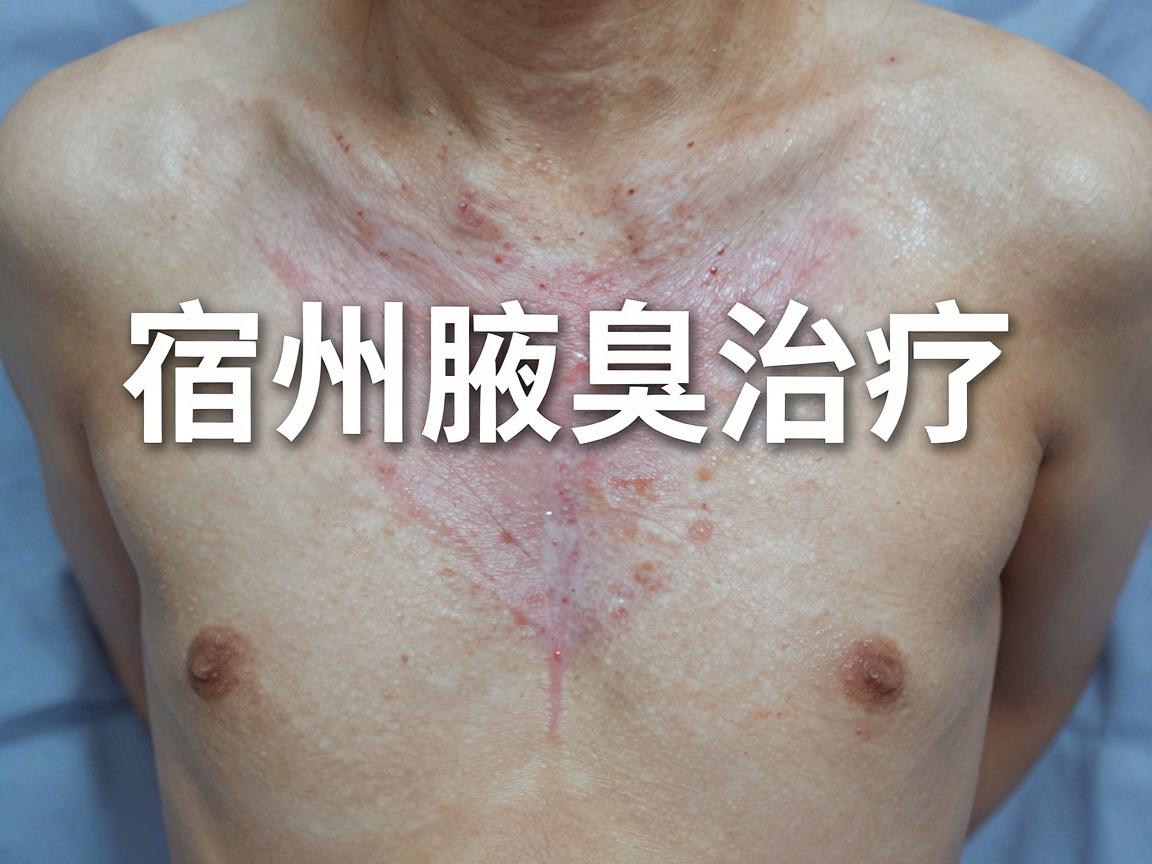 宿州腋下微创手术医院怎么选？宿州腋臭治疗指南来了
