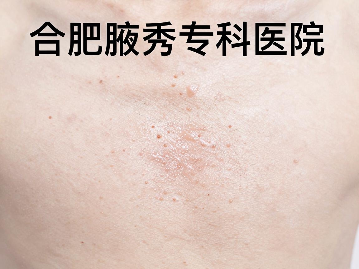 合肥腋臭治疗哪家医院效果最好？合肥腋秀专科医院深度解析