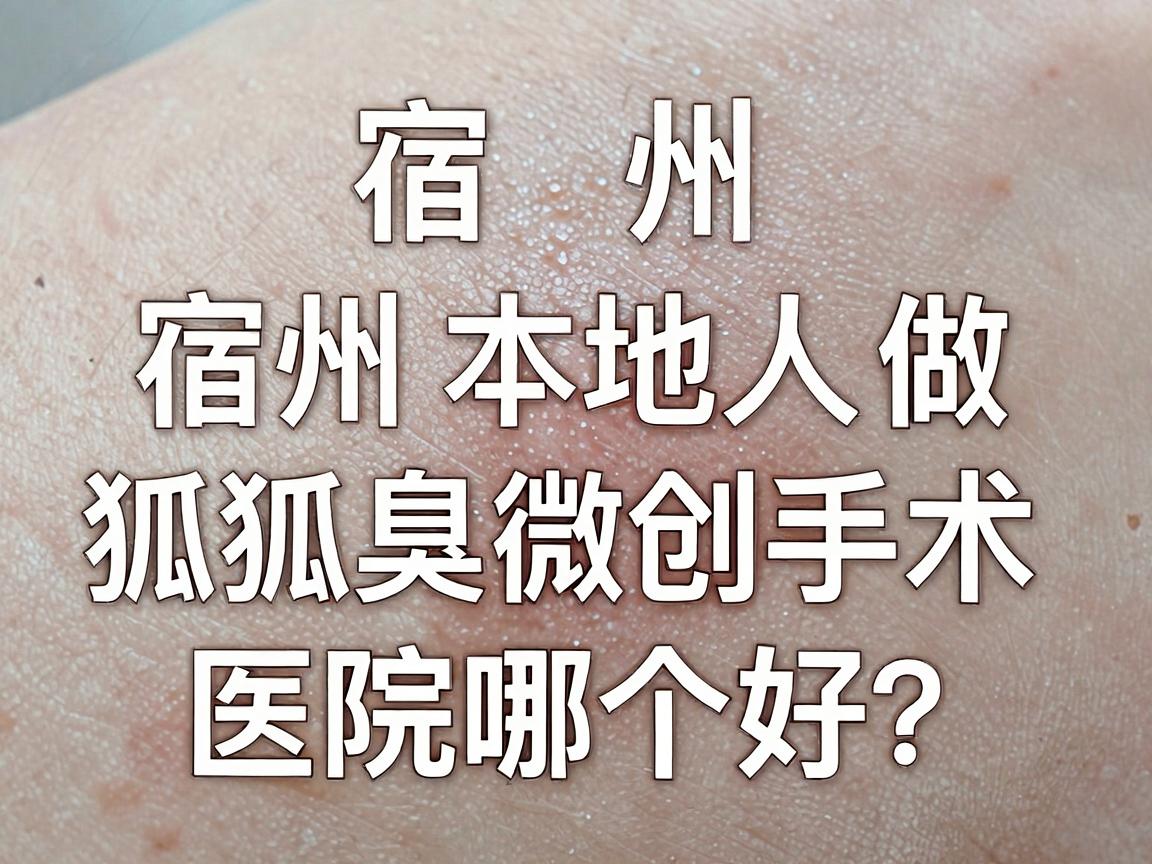 宿州狐臭微创手术医院哪个好?宿州本地人做狐臭微创手术,这篇对比指南请收好 宿州狐臭微创手术医院哪个好?宿州本地人做狐臭微创手术,这篇对比指南请收好