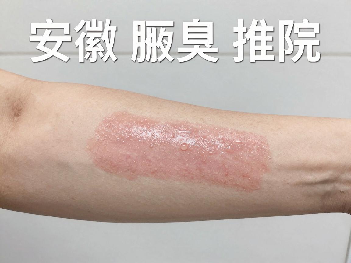 安徽腋臭医院推荐,专业腋臭治疗,告别腋臭尴尬 安徽腋臭医院推荐,专业腋臭治疗,告别腋臭尴尬