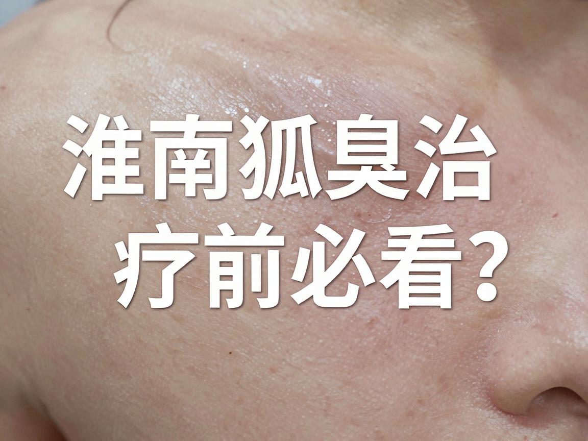 淮南狐臭医院怎么选?淮南狐臭治疗前必看的3个关键点 淮南狐臭医院怎么选?淮南狐臭治疗前必看的3个关键点