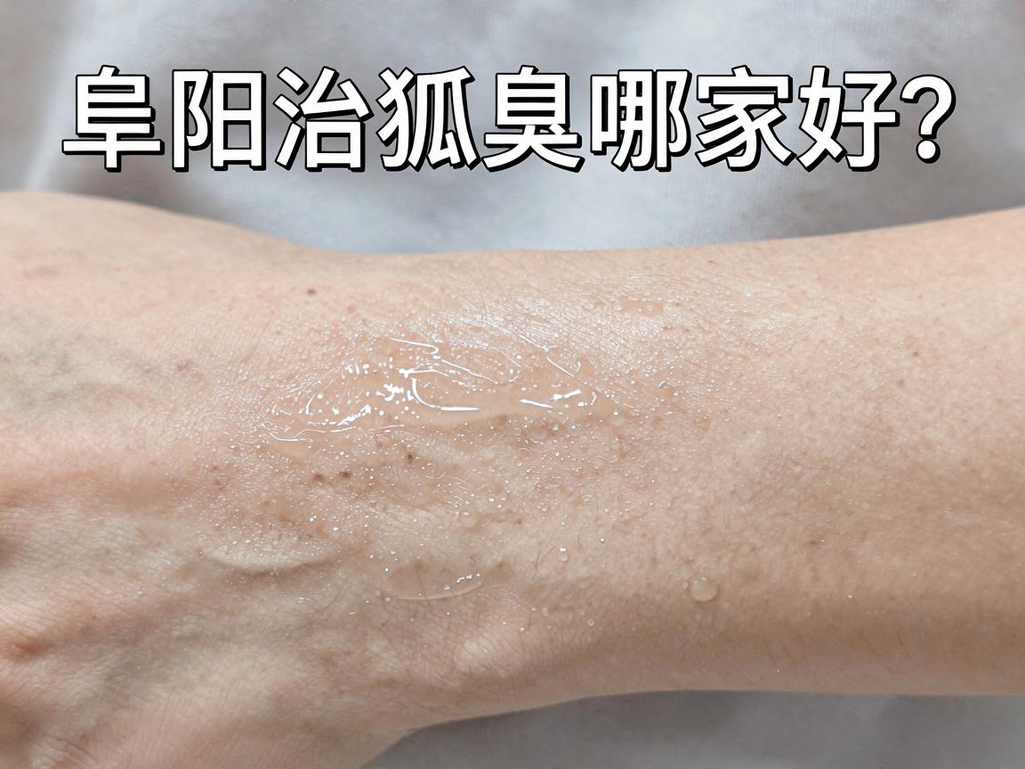 阜阳治狐臭哪家好?专业医生告诉你,阜阳治疗狐臭选对方法才叫好 阜阳治狐臭哪家好?专业医生告诉你,阜阳治疗狐臭选对方法才叫好