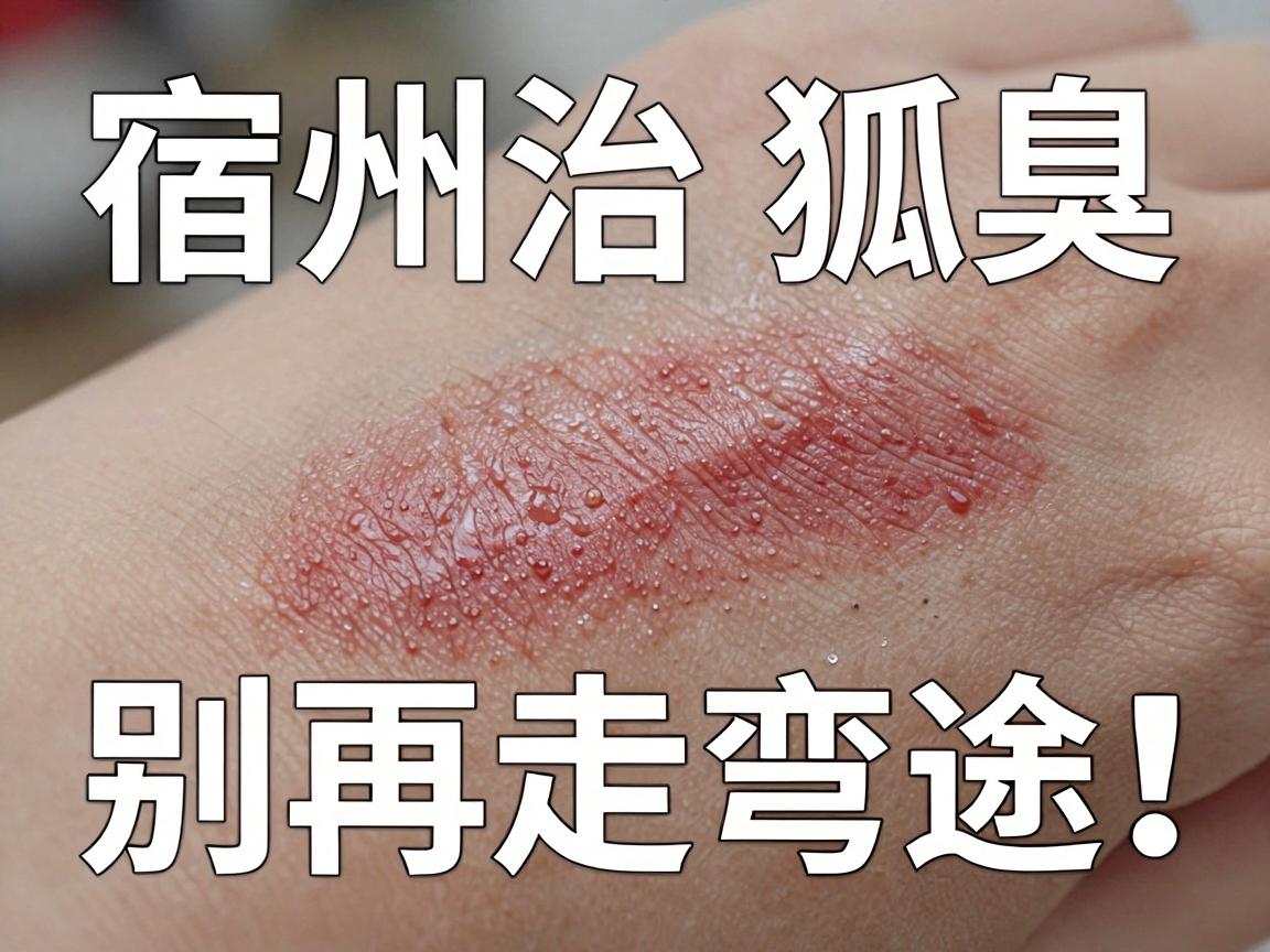 宿州治狐臭,别再走弯路!宿州正规医院该如何选? 宿州治狐臭,别再走弯路!宿州正规医院该如何选?