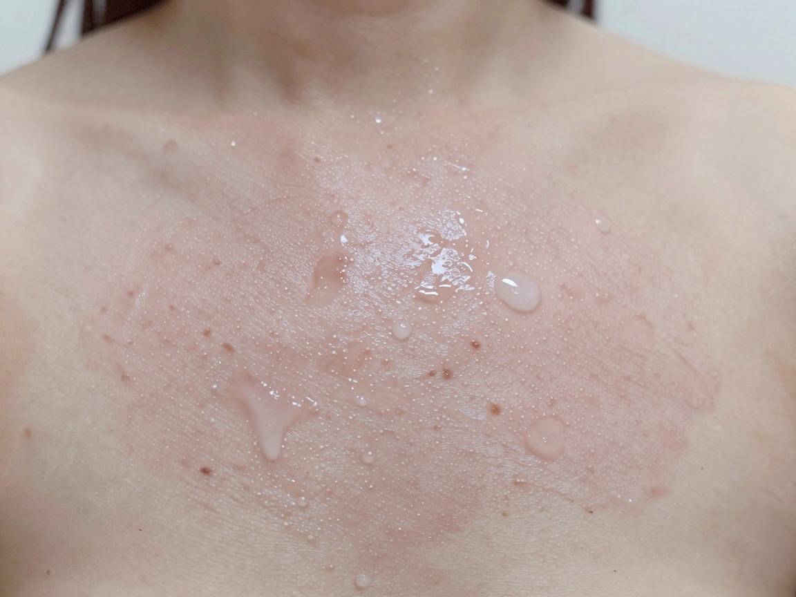 六安治疗腋臭的医院怎么选?六安腋臭治疗别走弯路 六安治疗腋臭的医院怎么选?六安腋臭治疗别走弯路