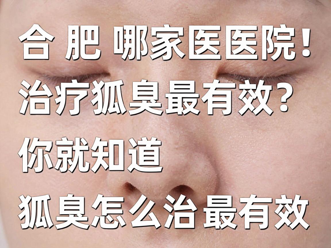 合肥哪家医院治疗狐臭最有效?看完这篇你就知道狐臭怎么治最有效 合肥哪家医院治疗狐臭最有效?看完这篇你就知道狐臭怎么治最有效