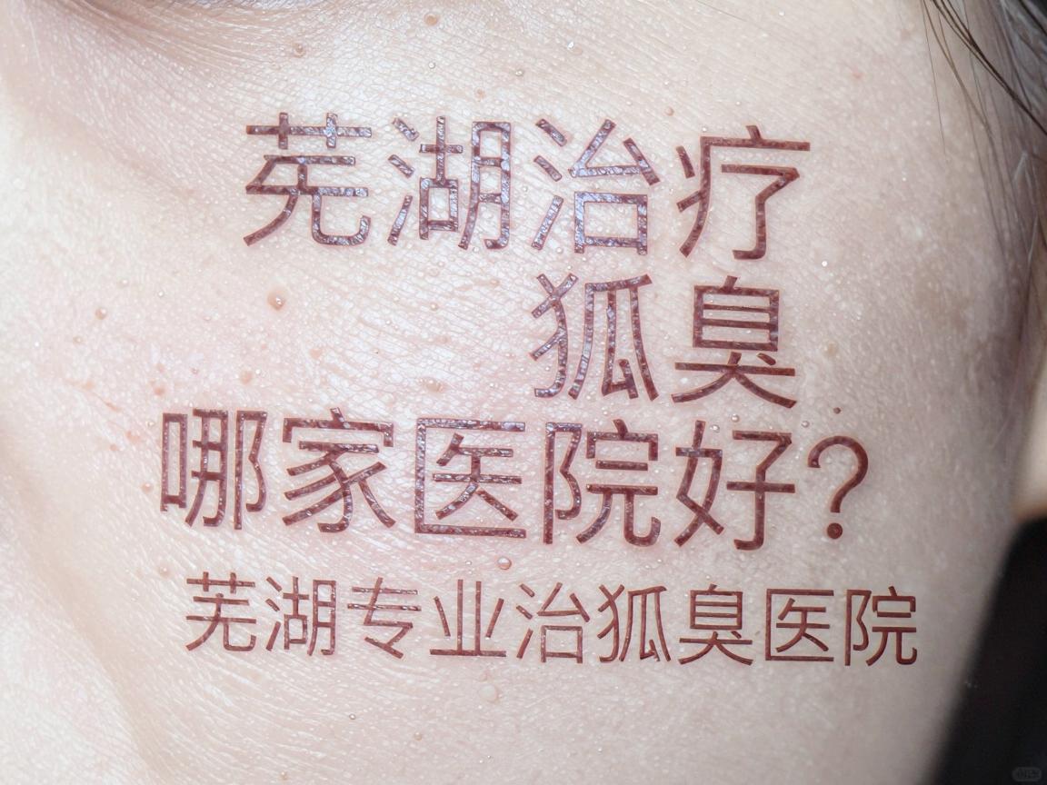芜湖治疗狐臭哪家医院好?深度测评芜湖专业治狐臭医院 芜湖治疗狐臭哪家医院好?深度测评芜湖专业治狐臭医院