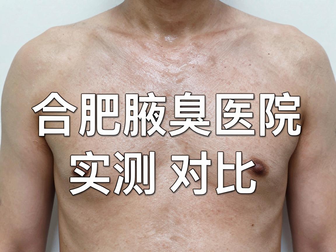 合肥腋下异味医院怎么选?合肥腋臭医院实测对比指南 合肥腋下异味医院怎么选?合肥腋臭医院实测对比指南