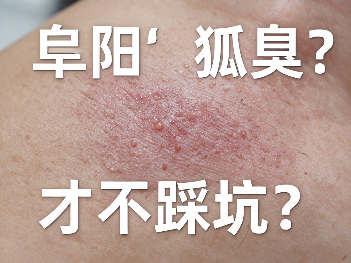 阜阳狐臭微创手术哪家好?阜阳狐臭微创术怎么选才不踩坑? 阜阳狐臭微创手术哪家好?阜阳狐臭微创术怎么选才不踩坑?