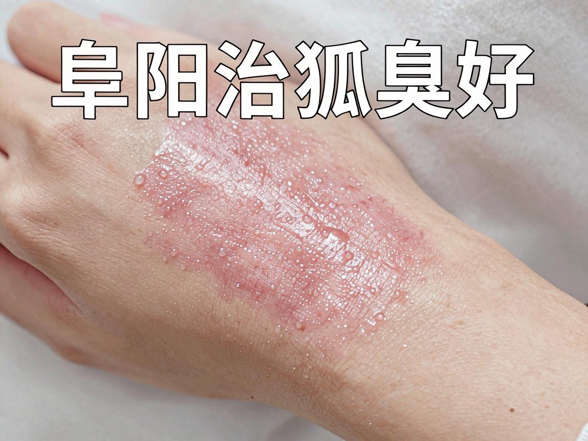阜阳治狐臭好的医院怎么选?阜阳治狐臭的医院攻略来了 阜阳治狐臭好的医院怎么选?阜阳治狐臭的医院攻略来了