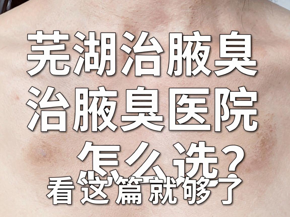 芜湖治腋臭,治腋臭医院怎么选?看这篇就够了 芜湖治腋臭,治腋臭医院怎么选?看这篇就够了