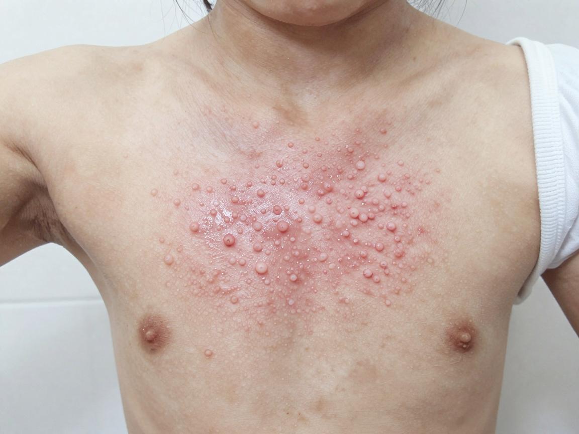 合肥儿童腋臭治疗,专业医院如何选择?儿童腋臭治疗要趁早 合肥儿童腋臭治疗,专业医院如何选择?儿童腋臭治疗要趁早