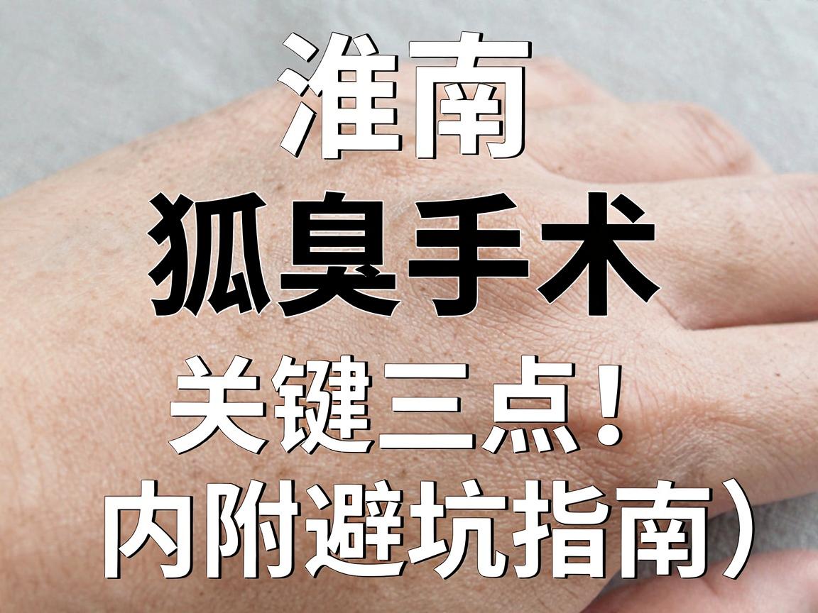 淮南狐臭手术去哪家?狐臭手术医院选择关键看三点!内附避坑指南) 淮南狐臭手术去哪家?狐臭手术医院选择关键看三点!内附避坑指南)
