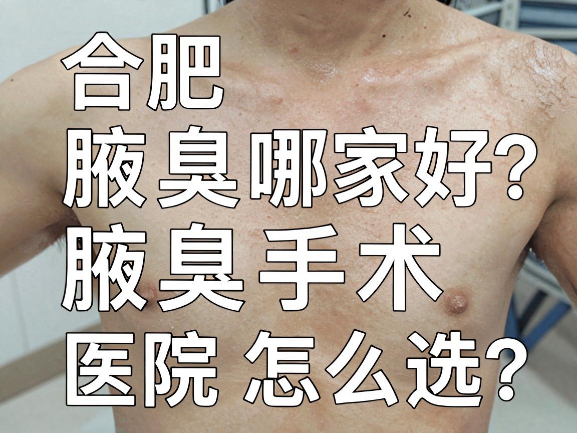 合肥腋臭医院哪家好?腋臭手术医院怎么选?这份攻略请收好 合肥腋臭医院哪家好?腋臭手术医院怎么选?这份攻略请收好