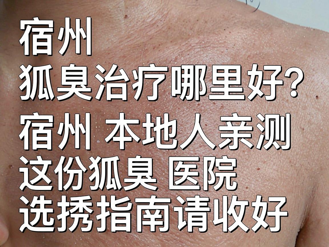 宿州狐臭治疗哪里好?宿州本地人亲测,这份狐臭医院选择指南请收好 宿州狐臭治疗哪里好?宿州本地人亲测,这份狐臭医院选择指南请收好