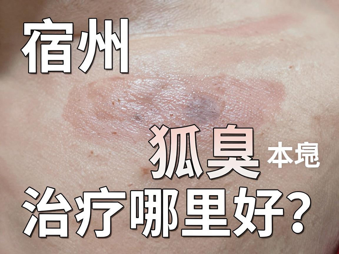 宿州狐臭治疗哪里好?宿州本地人亲测,这份狐臭医院选择指南请收好 宿州狐臭治疗哪里好?宿州本地人亲测,这份狐臭医院选择指南请收好