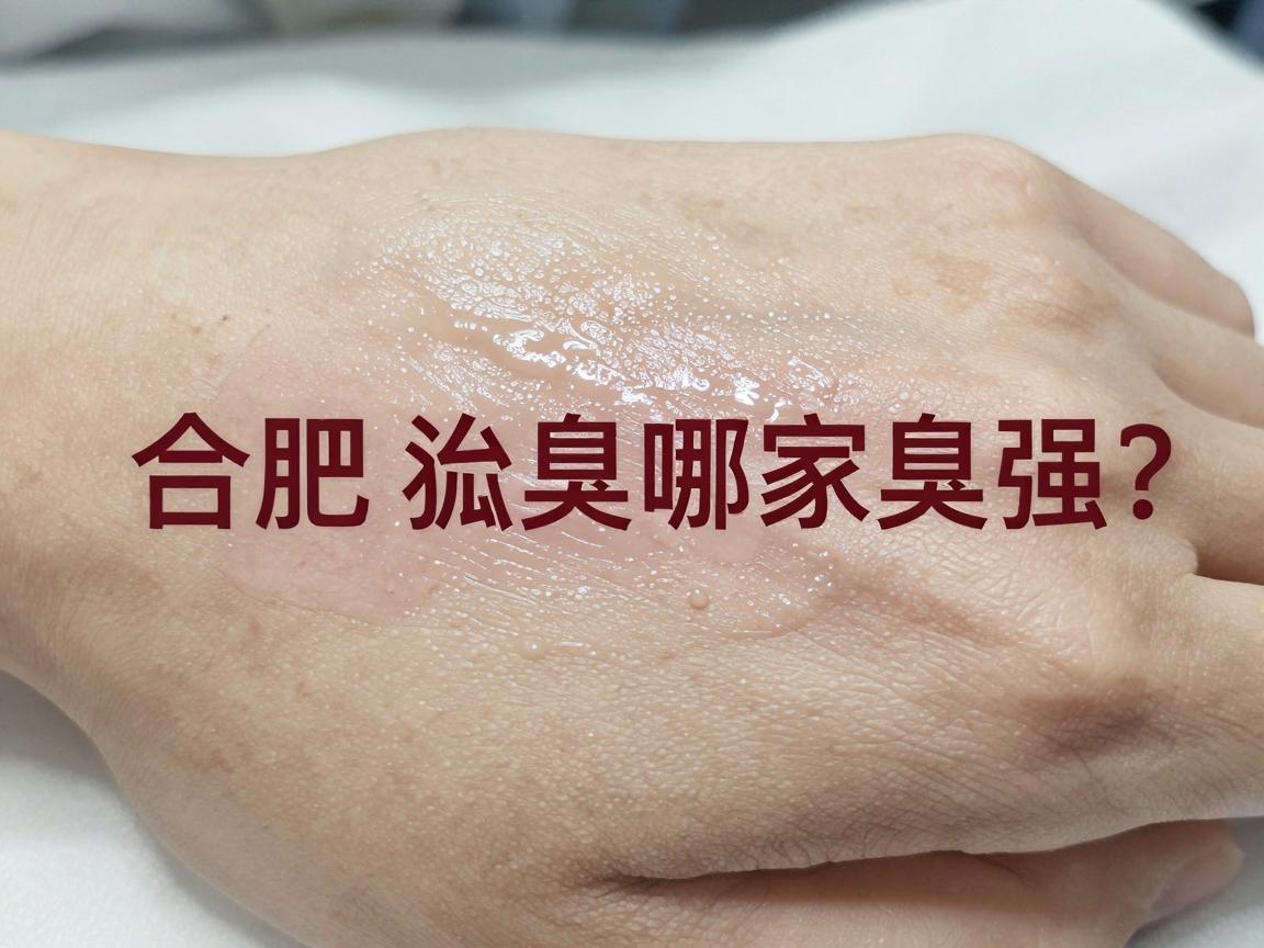 合肥治疗狐臭哪家强？这家医院治疗狐臭的隐藏实力你了解吗？