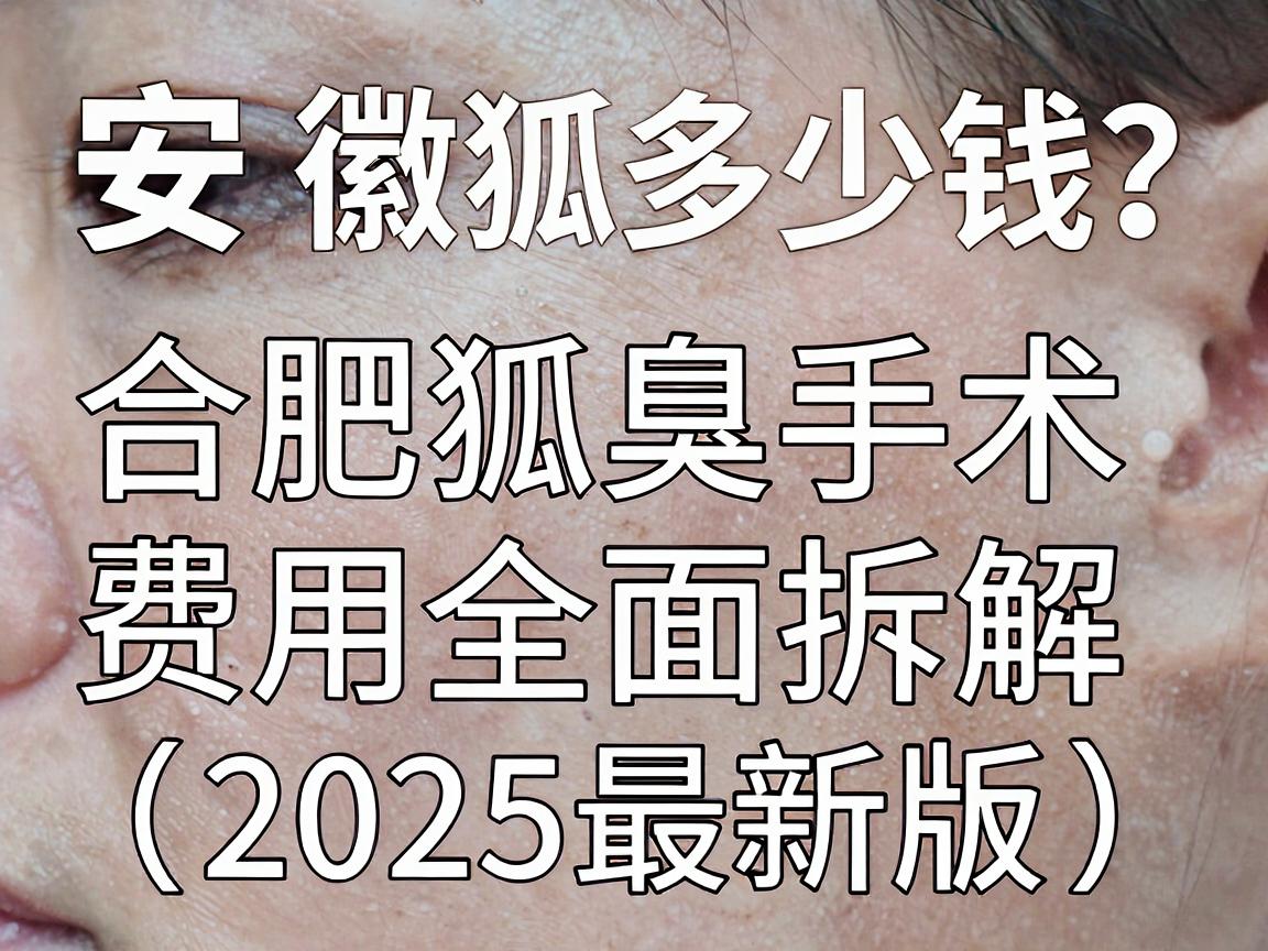 安徽狐臭手术多少钱?合肥狐臭手术费用全面拆解(2025最新版) 安徽狐臭手术多少钱?合肥狐臭手术费用全面拆解(2025最新版)
