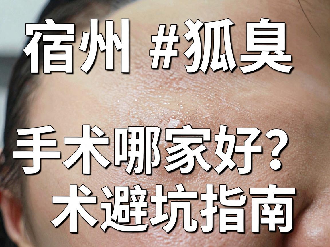宿州狐臭手术哪家好?别急着选,先看这份宿州腋臭手术避坑指南 宿州狐臭手术哪家好?别急着选,先看这份宿州腋臭手术避坑指南