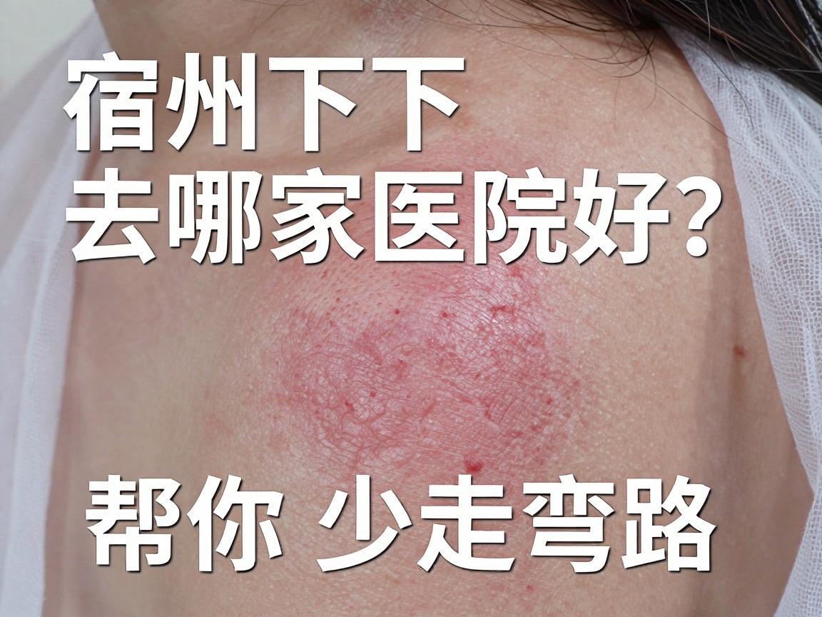 宿州腋下微创手术去哪家医院好？这份宿州就医指南帮你少走弯路