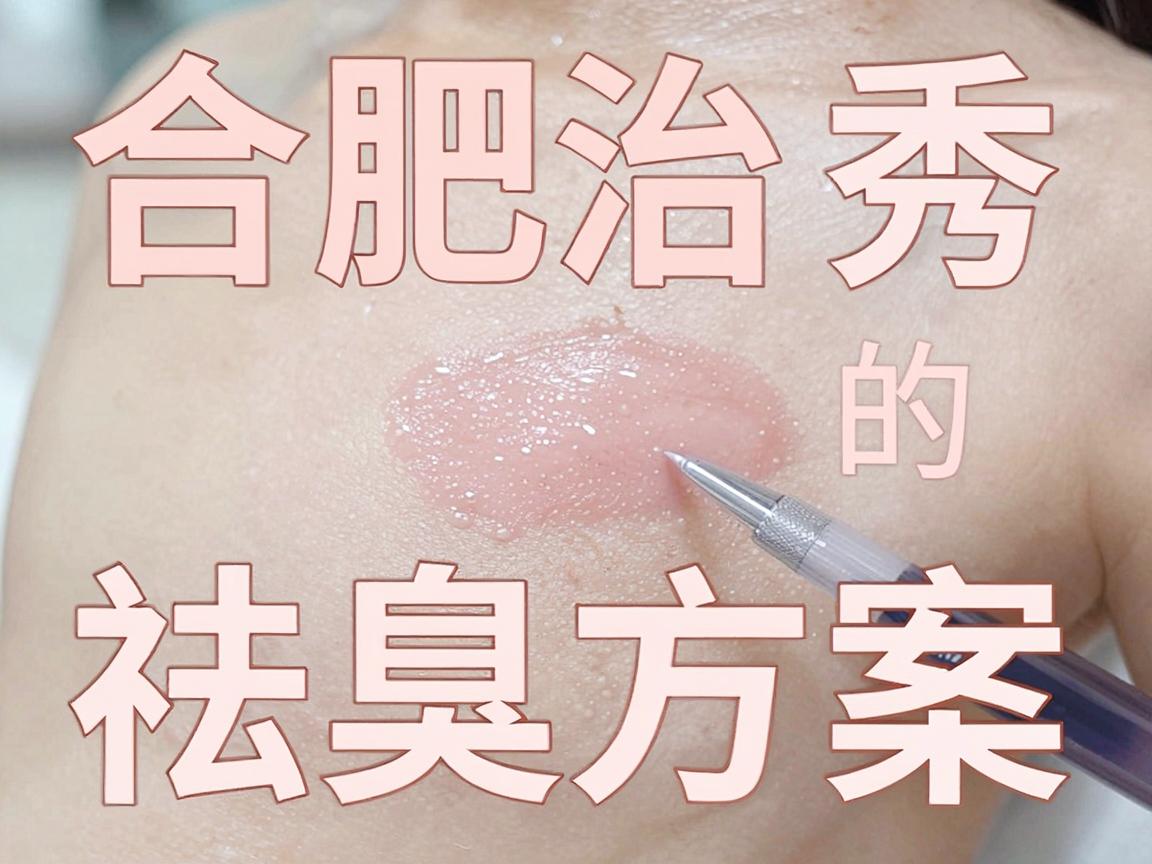 合肥治疗狐臭选哪家医院?合肥腋秀的祛臭方案深度拆解 合肥治疗狐臭选哪家医院?合肥腋秀的祛臭方案深度拆解