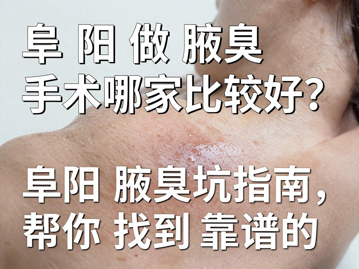 阜阳做腋臭手术哪家比较好?这份阜阳腋臭手术避坑指南,帮你找到靠谱的阜阳腋臭手术机构 阜阳做腋臭手术哪家比较好?这份阜阳腋臭手术避坑指南,帮你找到靠谱的阜阳腋臭手术机构