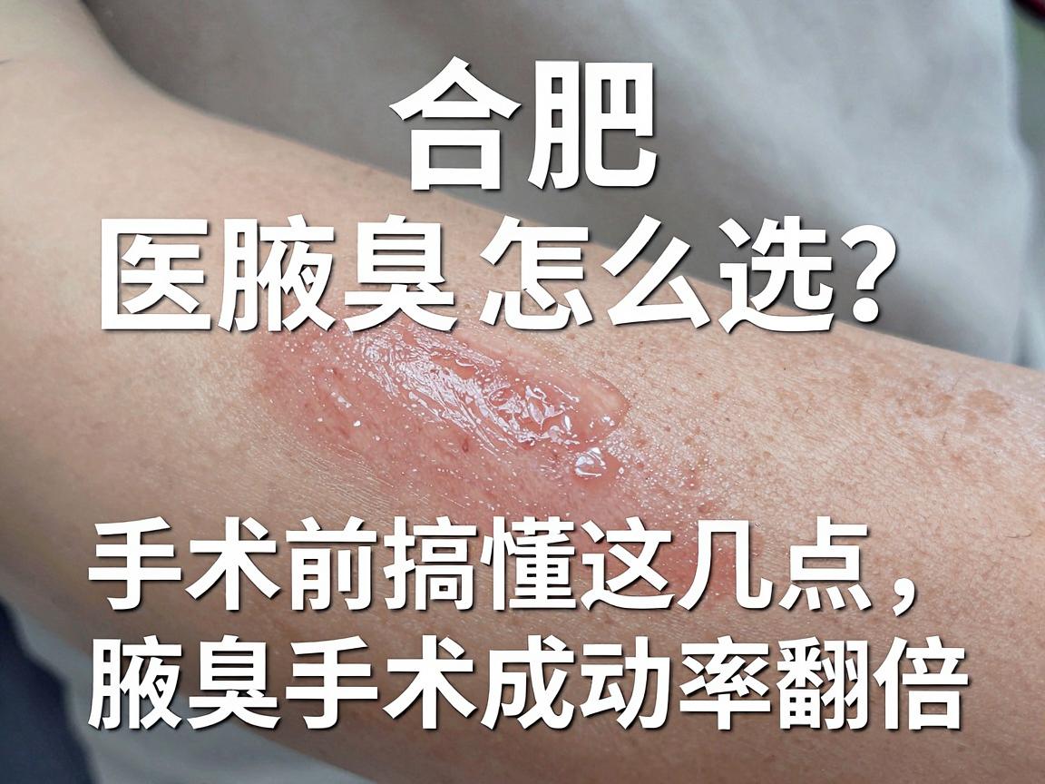合肥腋臭手术医院怎么选?手术前搞懂这几点,腋臭手术成功率翻倍 合肥腋臭手术医院怎么选?手术前搞懂这几点,腋臭手术成功率翻倍