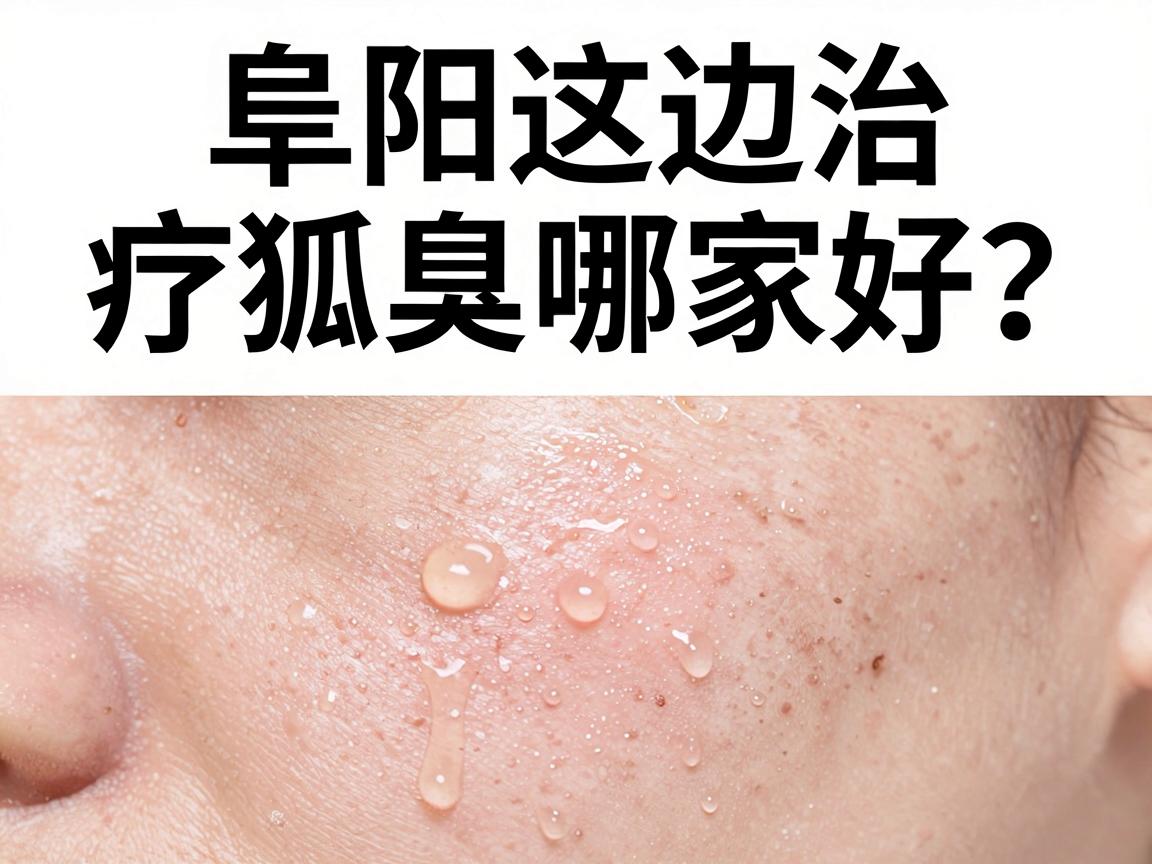 阜阳这边治疗狐臭哪家好?别急着选,先看这3个硬指标评估狐臭治疗好与坏 阜阳这边治疗狐臭哪家好?别急着选,先看这3个硬指标评估狐臭治疗好与坏