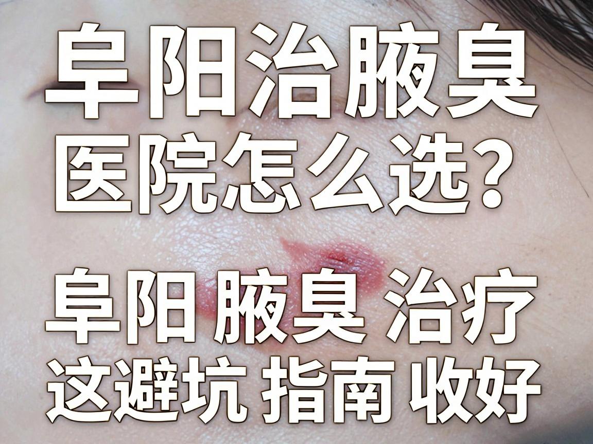 阜阳治腋臭，医院怎么选？阜阳腋臭治疗，这份避坑指南收好