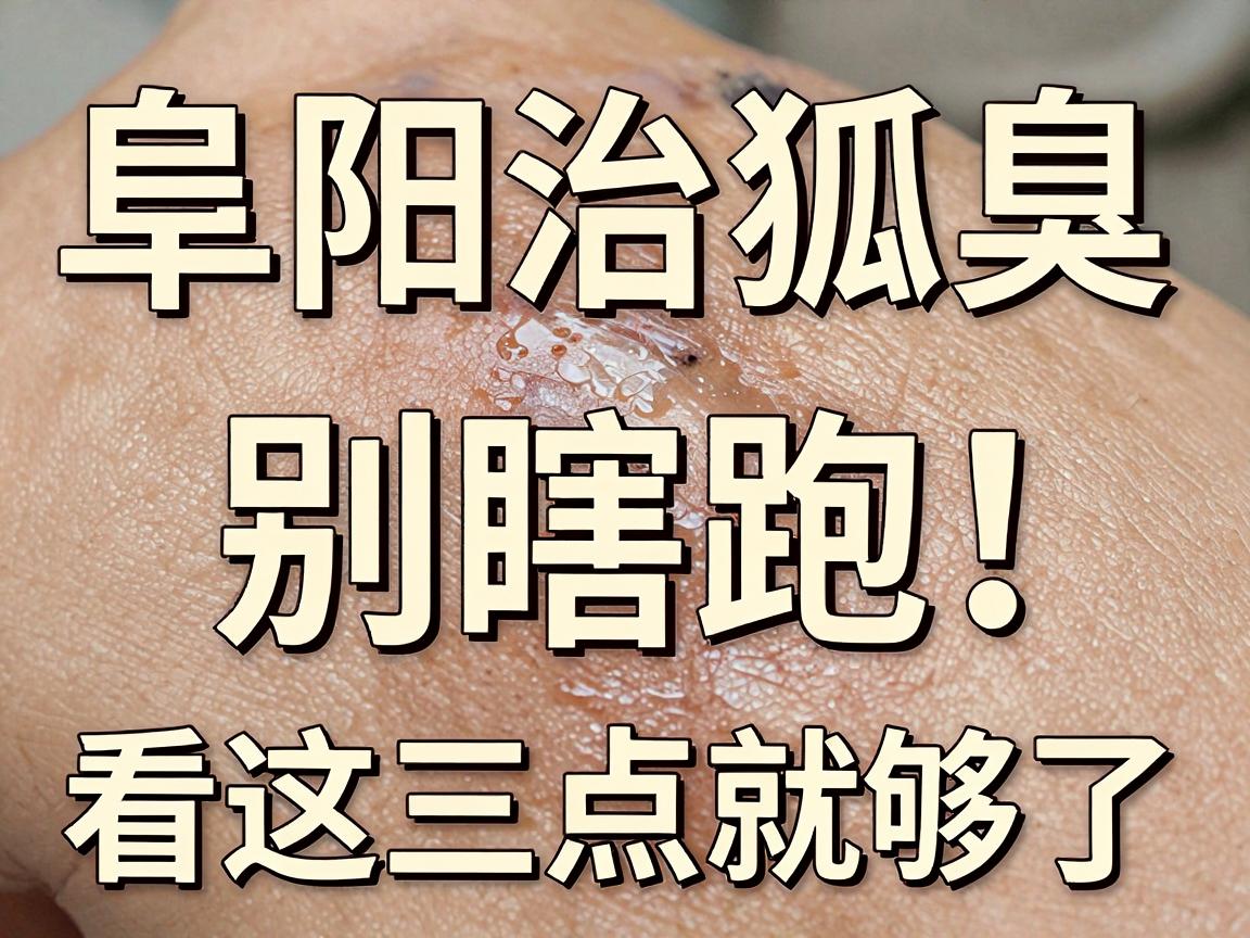 阜阳治狐臭,别瞎跑!阜阳狐臭医院怎么选,看这三点就够了 阜阳治狐臭,别瞎跑!阜阳狐臭医院怎么选,看这三点就够了