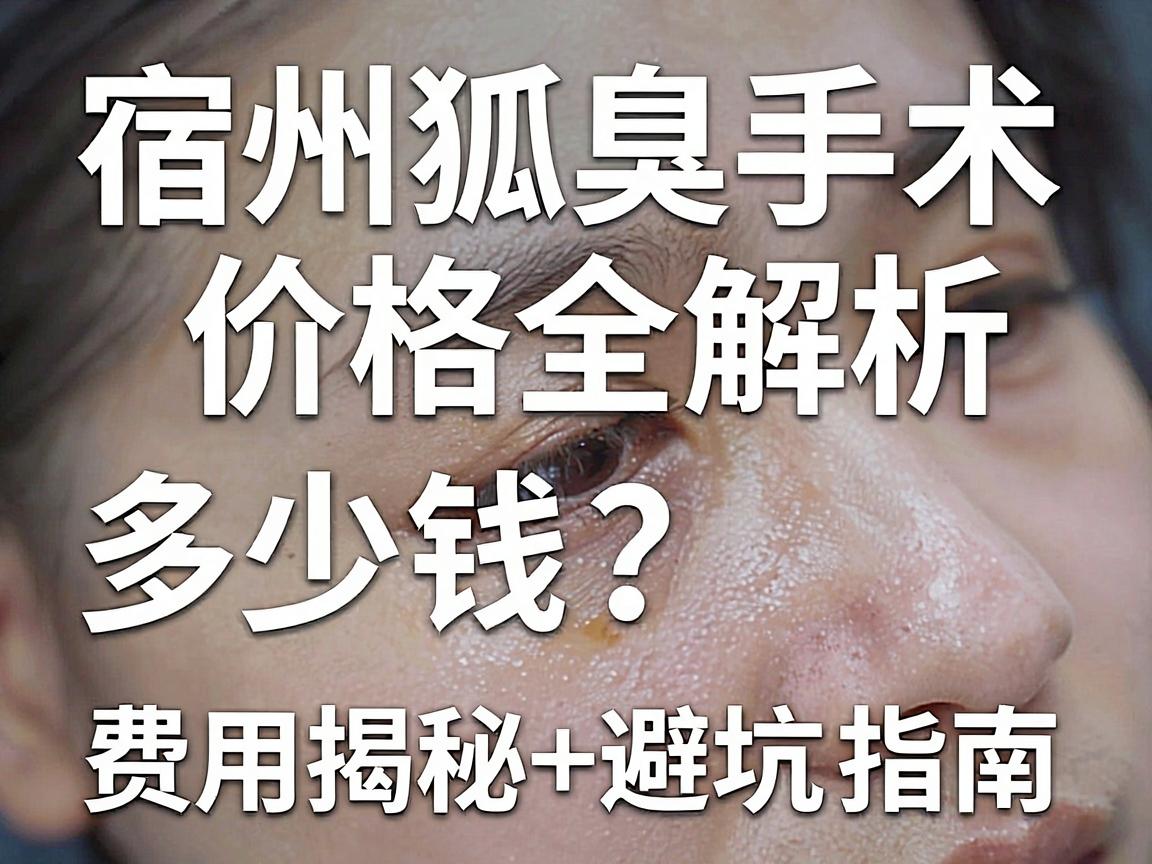 宿州狐臭手术多少钱?费用揭秘+避坑指南,宿州狐臭手术价格全解析 宿州狐臭手术多少钱?费用揭秘+避坑指南,宿州狐臭手术价格全解析