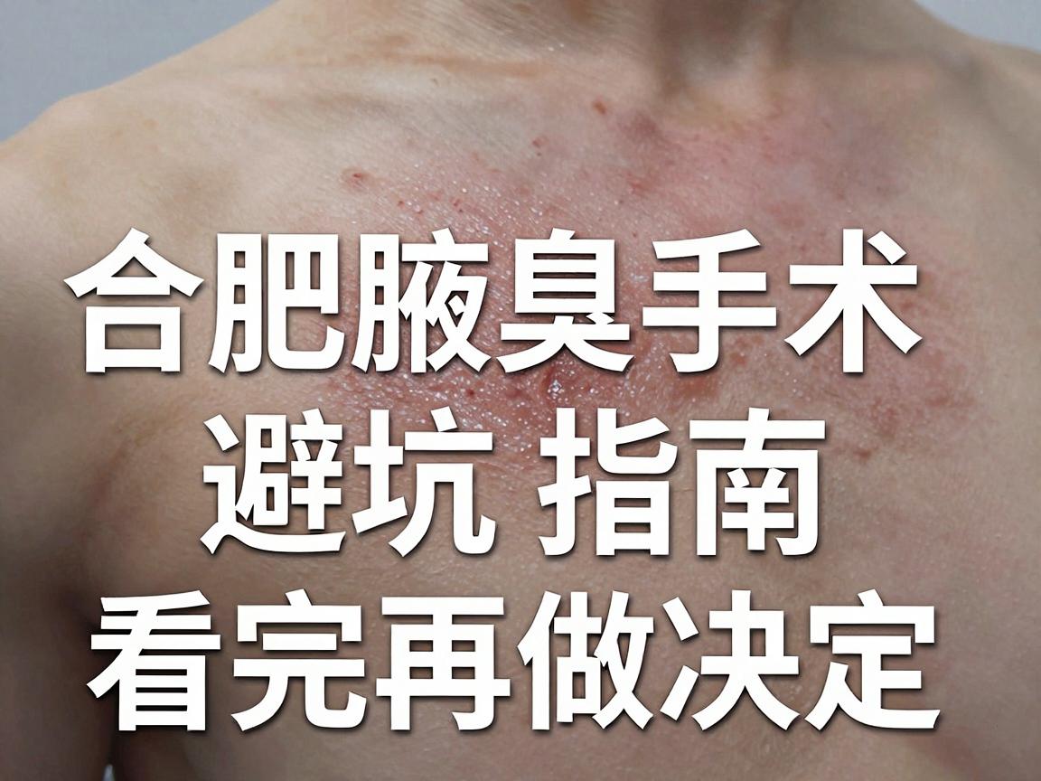 合肥腋臭手术怎么选?合肥腋臭手术避坑指南,看完再做决定 合肥腋臭手术怎么选?合肥腋臭手术避坑指南,看完再做决定