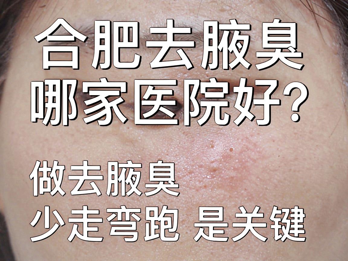 合肥去腋臭哪家医院好?选对医院做去腋臭,少走弯路是关键 合肥去腋臭哪家医院好?选对医院做去腋臭,少走弯路是关键