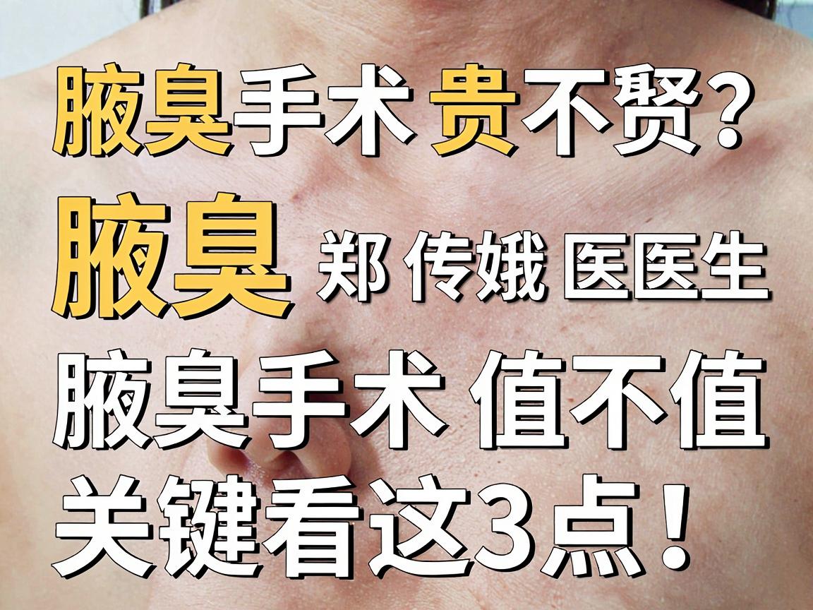 腋臭手术价格贵不贵？合肥腋秀腋臭郑传娥医生，腋臭手术值不值，关键看这3点！