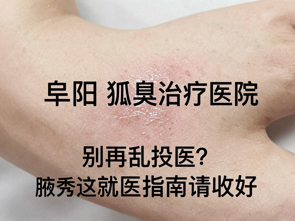 阜阳狐臭治疗医院怎么选？别再乱投医，腋秀这份阜阳就医指南请收好