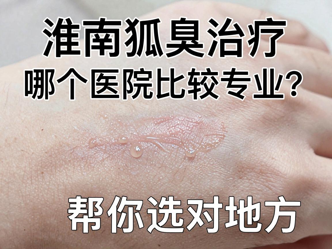 淮南看狐臭,哪个医院比较专业?淮南狐臭治疗,这三步帮你选对地方 淮南看狐臭,哪个医院比较专业?淮南狐臭治疗,这三步帮你选对地方