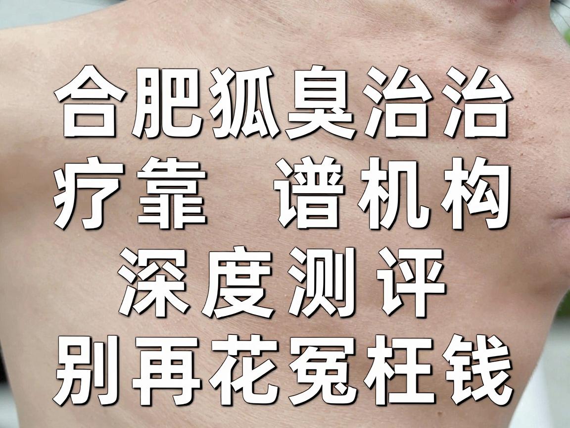 合肥腋臭医院怎么选?合肥狐臭治疗靠谱机构深度测评,别再花冤枉钱 合肥腋臭医院怎么选?合肥狐臭治疗靠谱机构深度测评,别再花冤枉钱