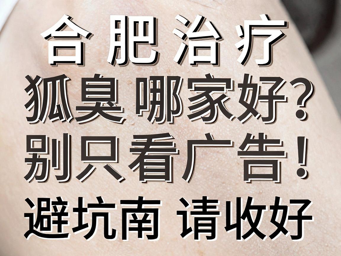 合肥治疗狐臭哪家好?别只看广告,合肥腋秀这份避坑指南请收好 合肥治疗狐臭哪家好?别只看广告,合肥腋秀这份避坑指南请收好