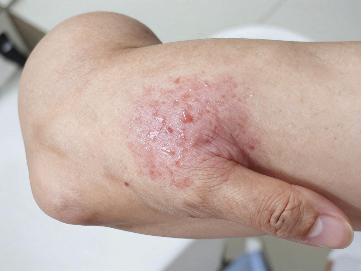 合肥腋秀是私立医院吗?聊聊腋秀医院的性质与看诊体验 合肥腋秀是私立医院吗?聊聊腋秀医院的性质与看诊体验