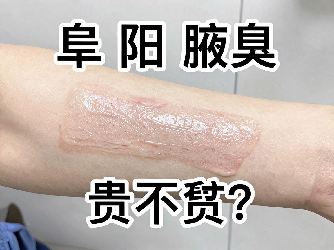 阜阳腋臭微创手术价格贵不贵?先看阜阳腋臭价格明细再决定 阜阳腋臭微创手术价格贵不贵?先看阜阳腋臭价格明细再决定