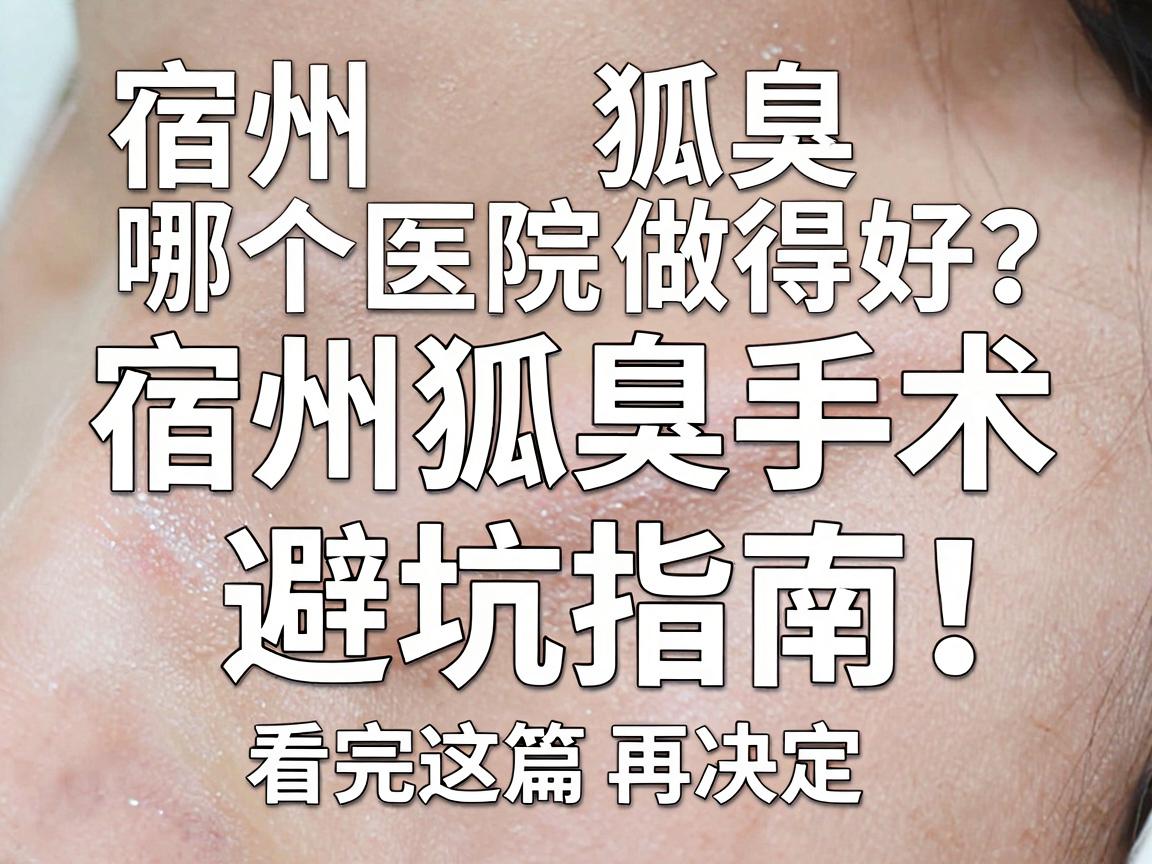 宿州狐臭手术哪个医院做得好?宿州狐臭手术避坑指南,看完这篇再决定 宿州狐臭手术哪个医院做得好?宿州狐臭手术避坑指南,看完这篇再决定