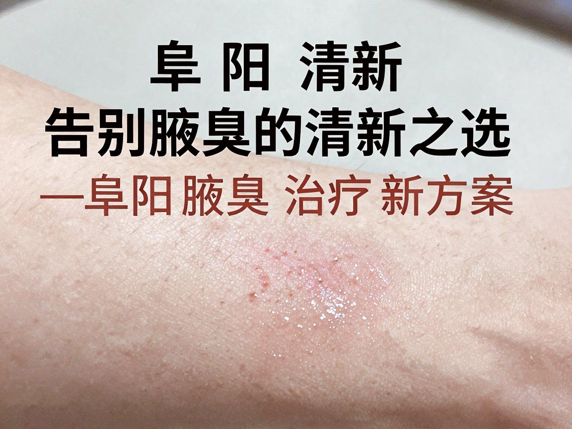 阜阳清新微波技术，告别腋臭的清新之选—阜阳腋臭治疗新方案