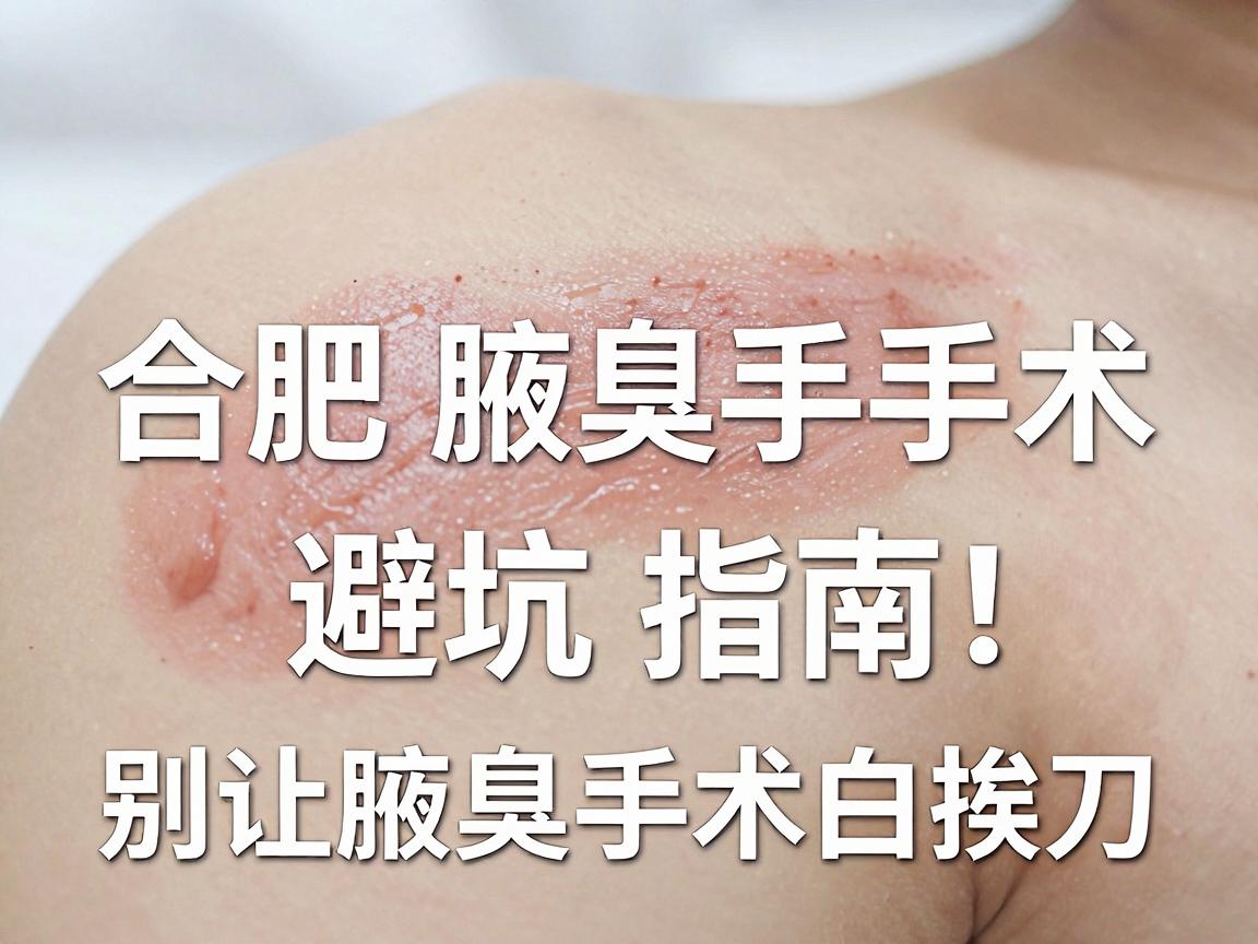 合肥腋臭手术怎么选?合肥腋臭手术医院避坑指南,别让腋臭手术白挨刀 合肥腋臭手术怎么选?合肥腋臭手术医院避坑指南,别让腋臭手术白挨刀