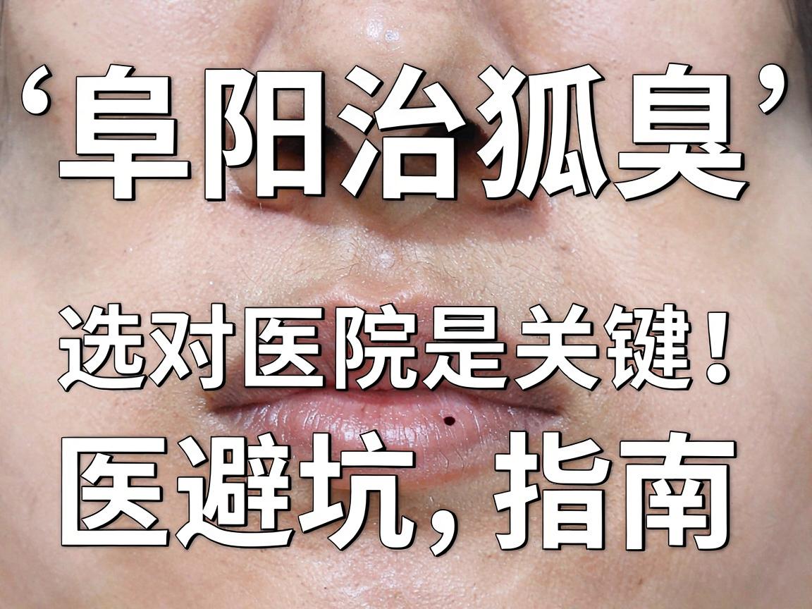 阜阳治狐臭，选对医院是关键！阜阳狐臭治疗医院避坑指南