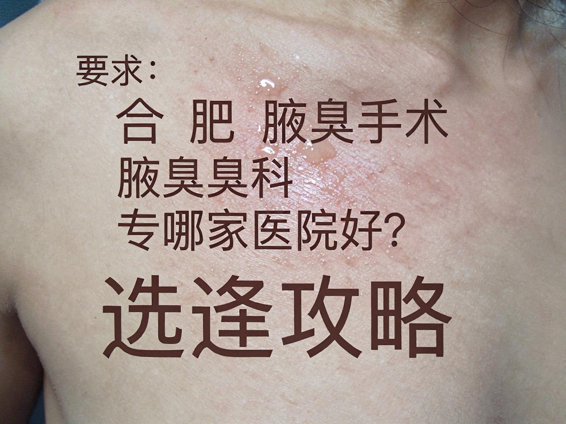 合肥腋臭手术哪家医院好?合肥腋臭专科医院选择攻略 合肥腋臭手术哪家医院好?合肥腋臭专科医院选择攻略