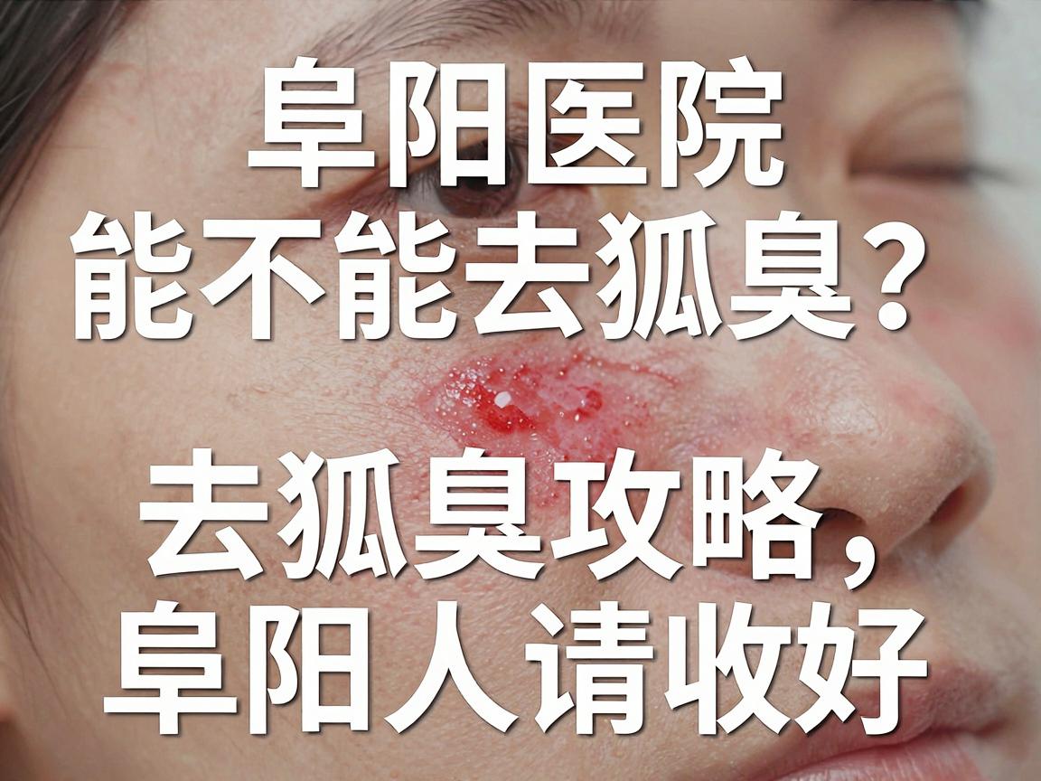 阜阳医院能不能去除狐臭?这份去狐臭攻略,阜阳人请收好 阜阳医院能不能去除狐臭?这份去狐臭攻略,阜阳人请收好